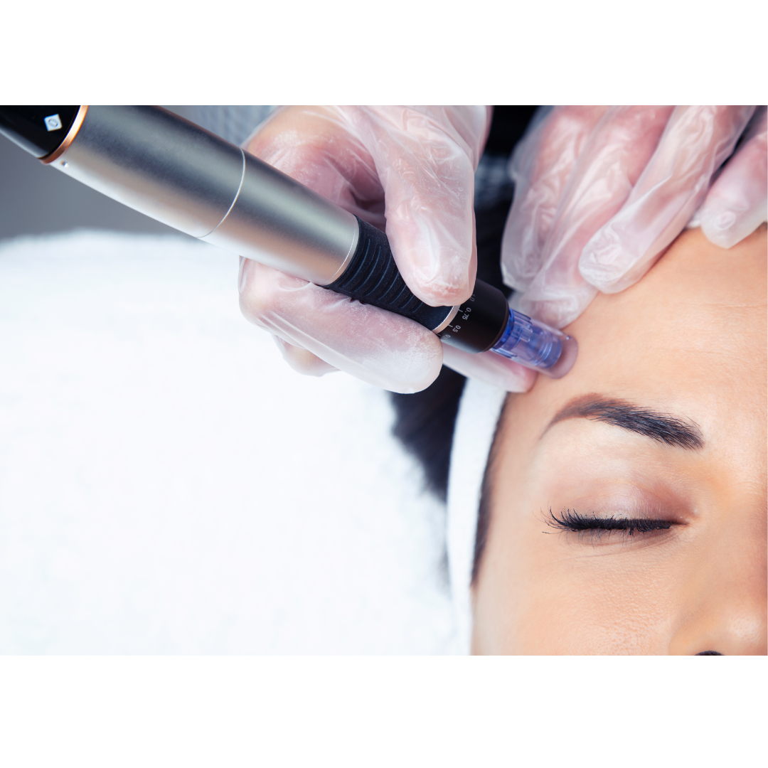 Mesotherapy Nano Micro Needle Treatment